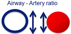 Airway-atery ratio (Inhaled antibiotics in bronchiectasis and cystic fibrosis (iABC) consortium)