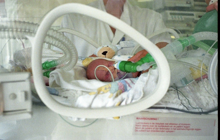 Te vroeg geboren baby in een couveuse