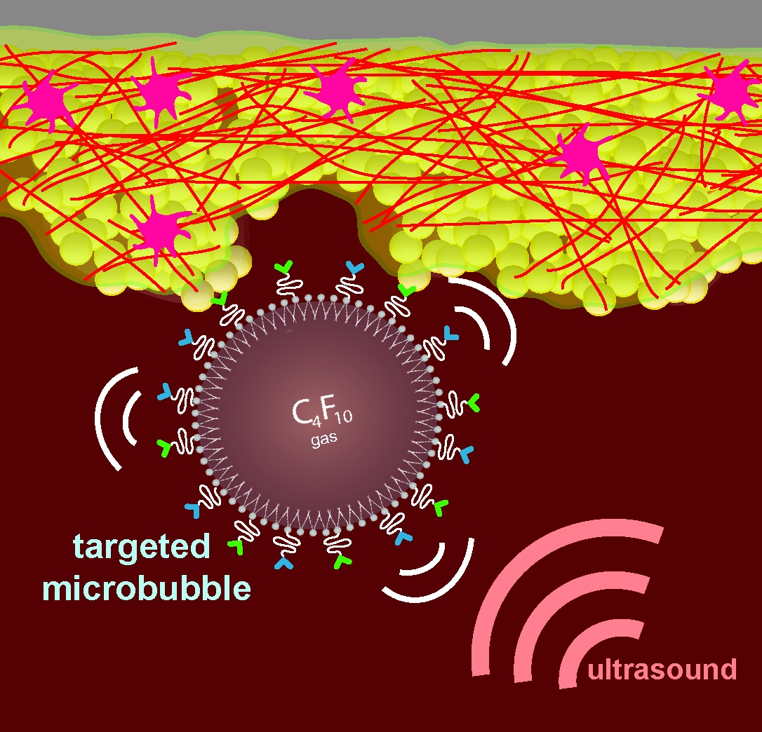 Therapeutic Ultrasound Contrast Agents