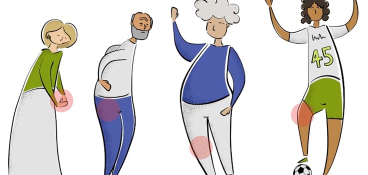Animatie van mensen met artrose in gewrichten Animatie van mensen met artrose in gewrichten