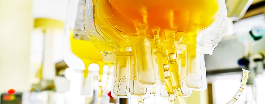 Headerbeeld bloed plasma bij pauze in CONcovid studie