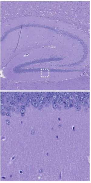 Molecular stem cell biology of lysosomal storage diseases