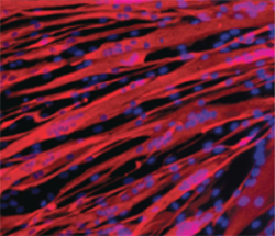 Molecular stem cell biology of lysosomal storage diseases