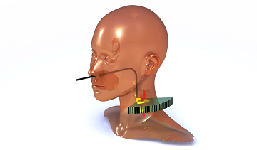 Imaging atherosclerotic plaque lipidomics in vivo Imaging atherosclerotic plaque lipidomics in vivo