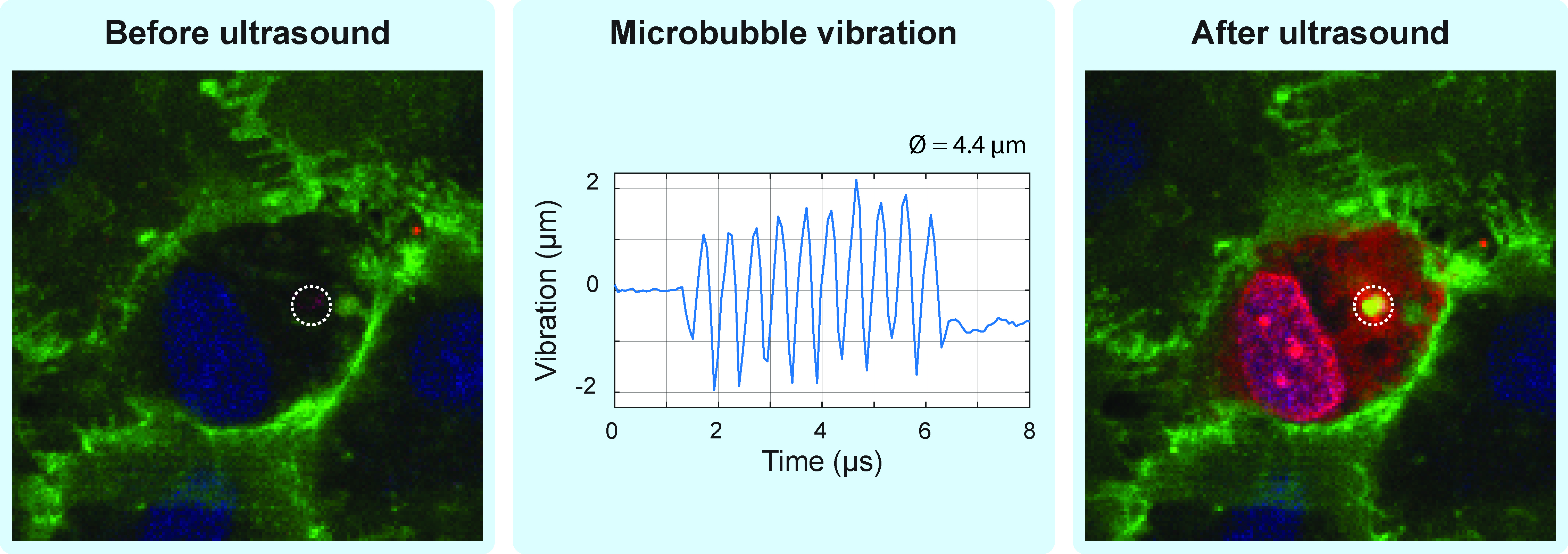 Microbubbles vibration