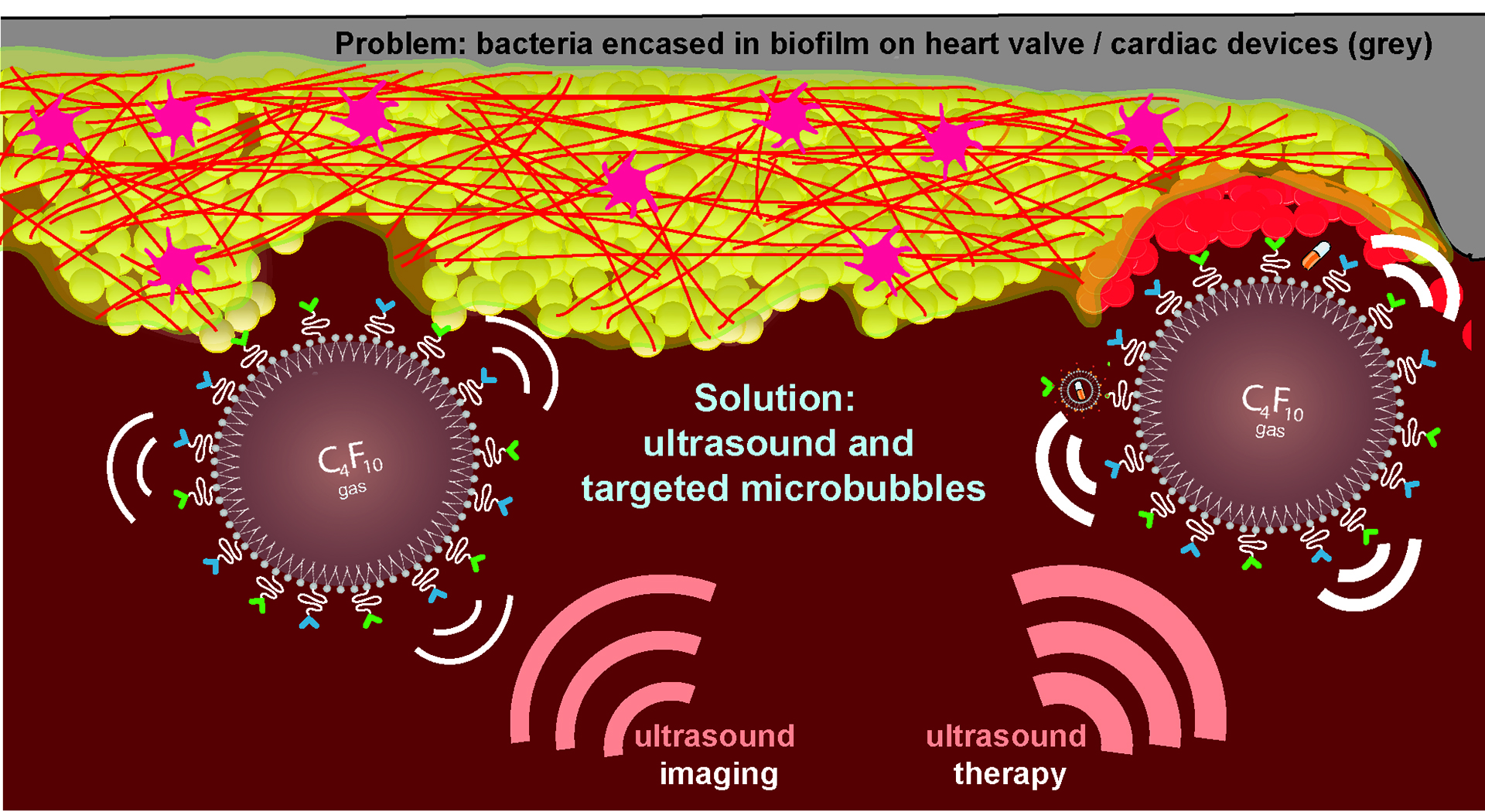Solution: ultrasound and microbubbles
