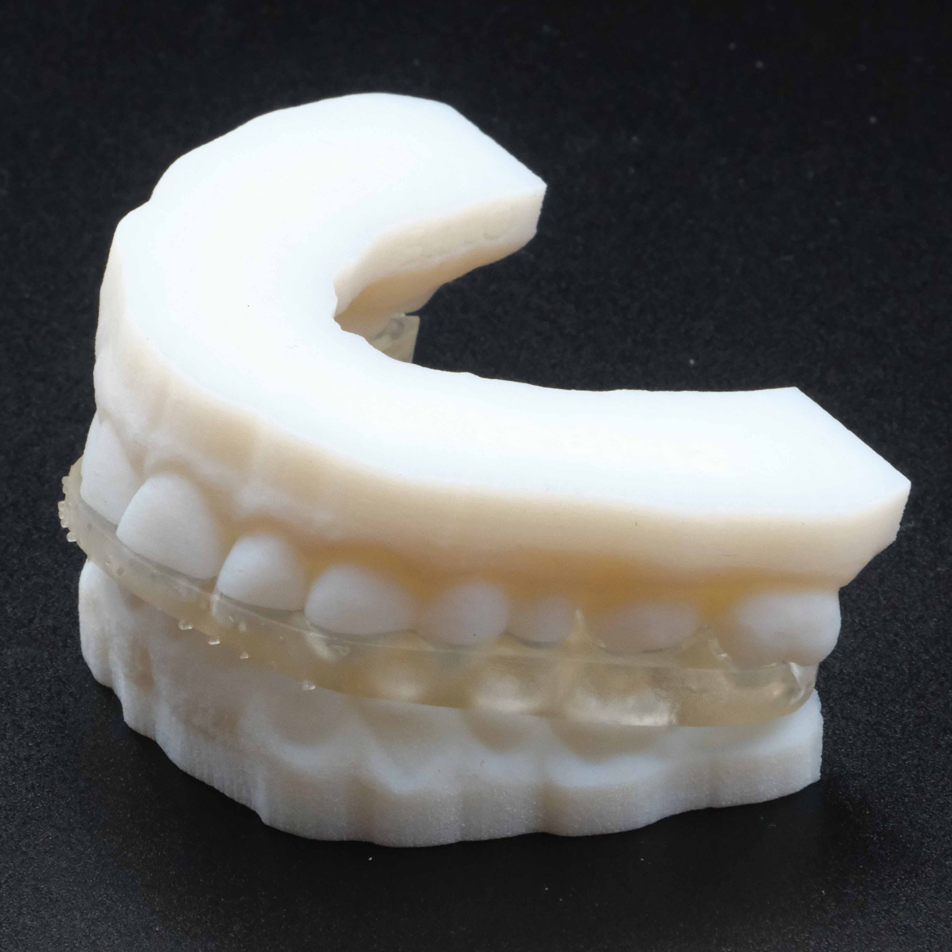 3d print Jaw model