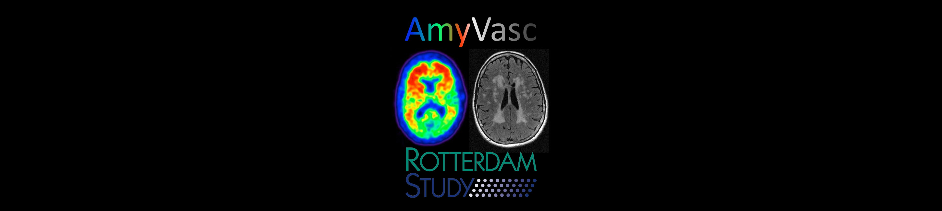 AmyVasc