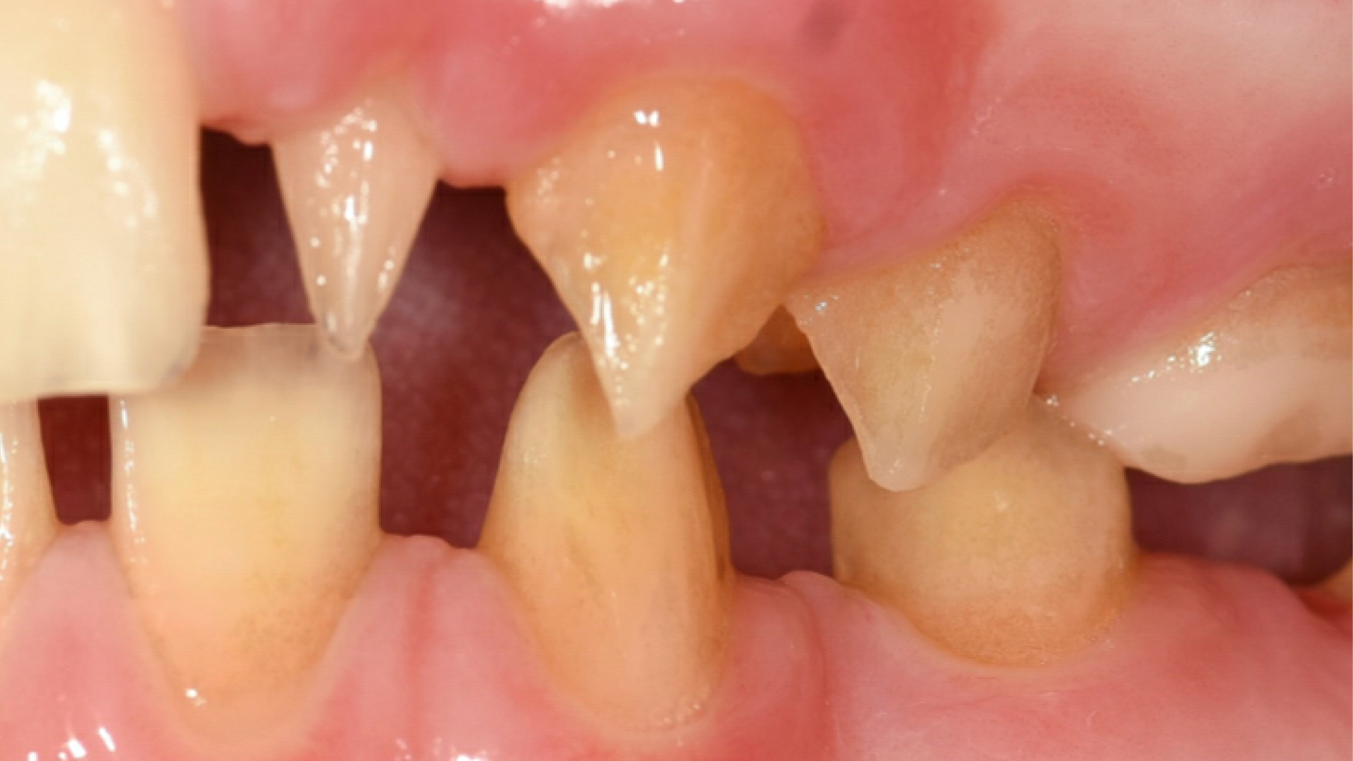 Orthodontie-afbeelding1