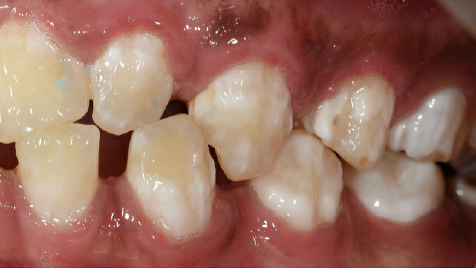 Orthodontie afbeelding3