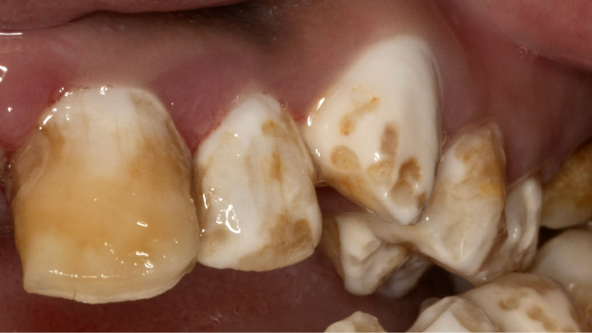 Orthodontie afbeelding 4